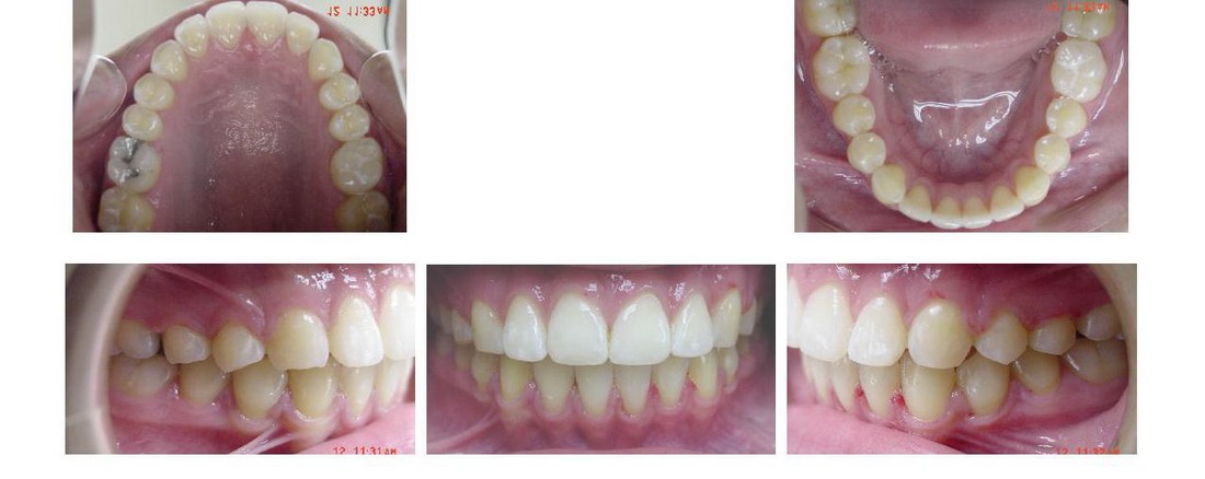 Pictures the dentist needs from a patient in case of a cosmetic treatment