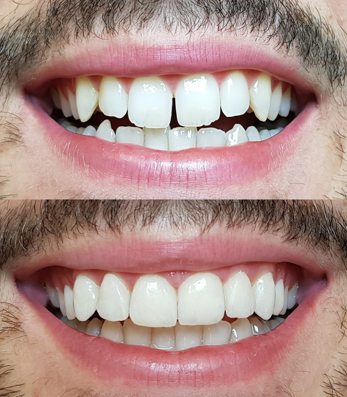 Low cost dental tourism in Hungary DentalTreatment.eu