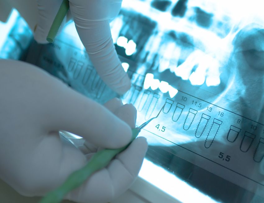 checking-dental-x-rays