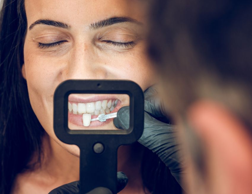 Average cost of dental veneers – Hungary vs the United Kingdom