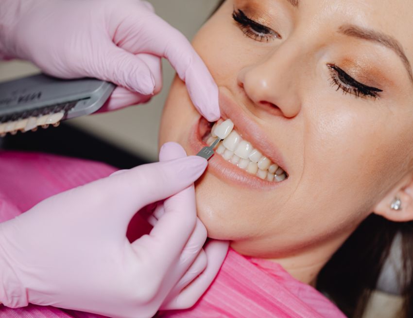 Choosing dental veneer