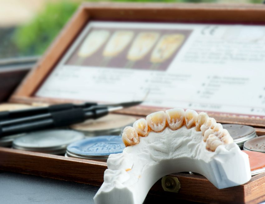 Dental crowns for American patients