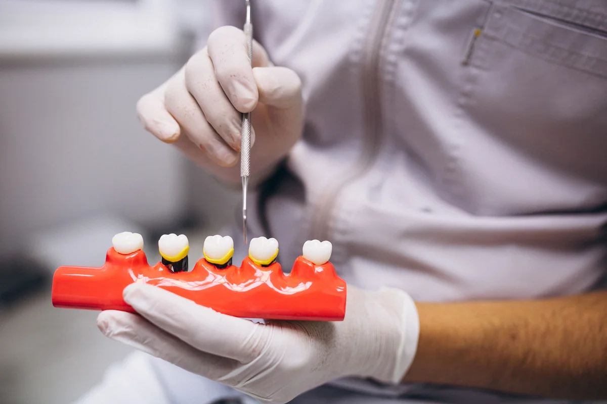 Zirconia vs. Porcelain-Fused-to-Metal Crowns