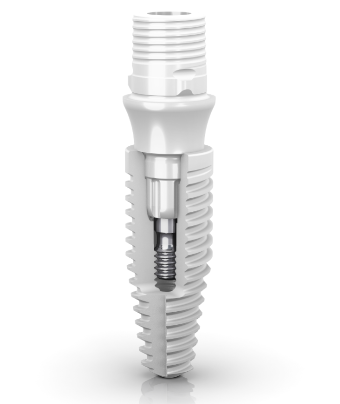 Full ceramic zirconia implant – metal-free dental implant system in Budapest
