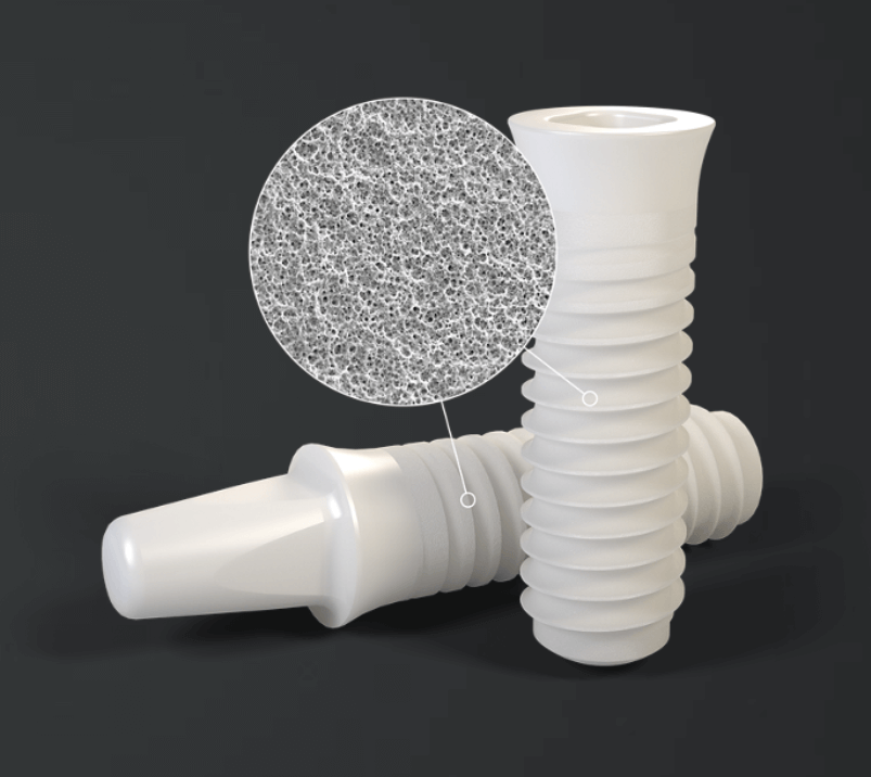 Full ceramic zirconia implant – metal-free dental implant system in Budapest