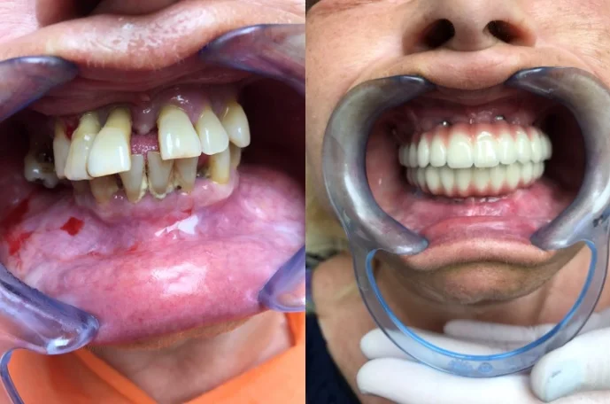 Dental Implant Centre