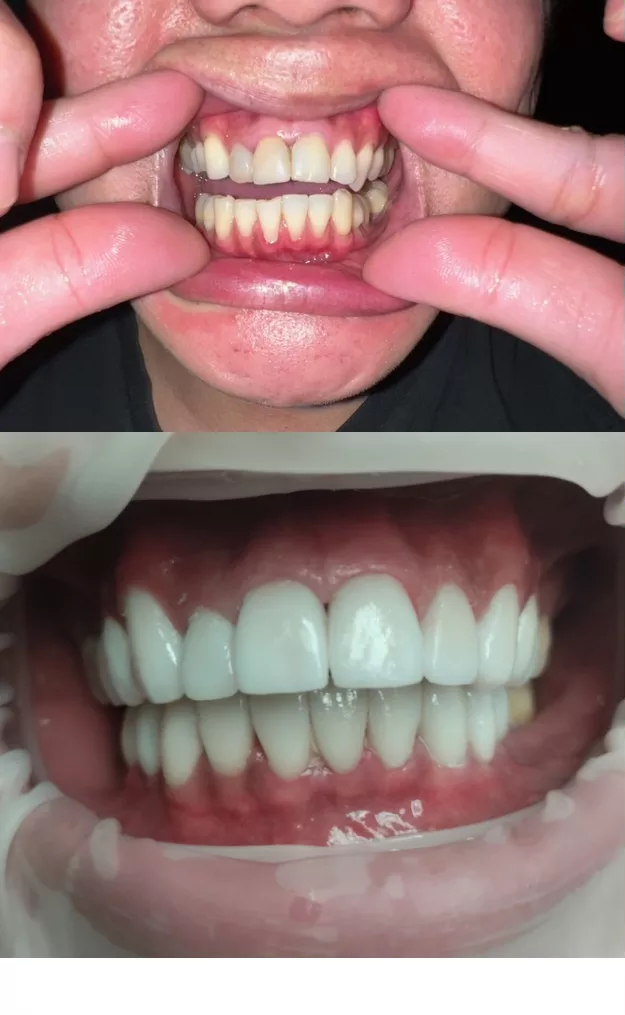 Reasons for Dental Travel from the US to Hungary