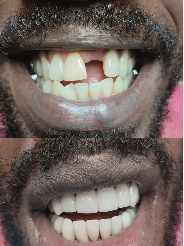 Reasons for Dental Travel from the US to Hungary