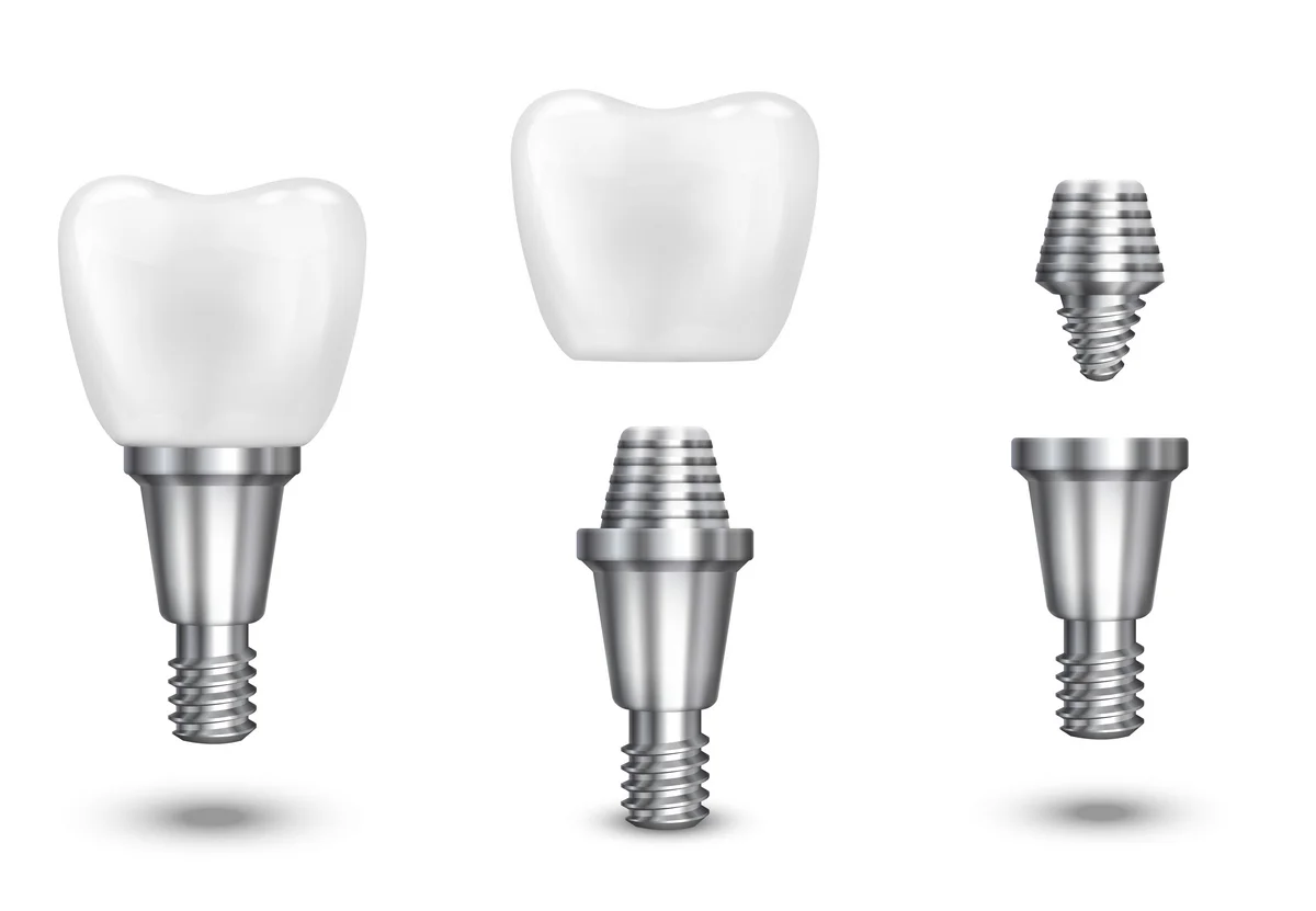 Dental Implant Centre