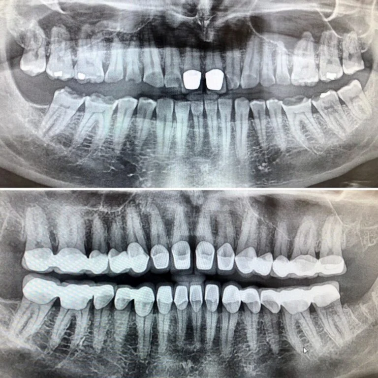 Low cost dental tourism in Hungary