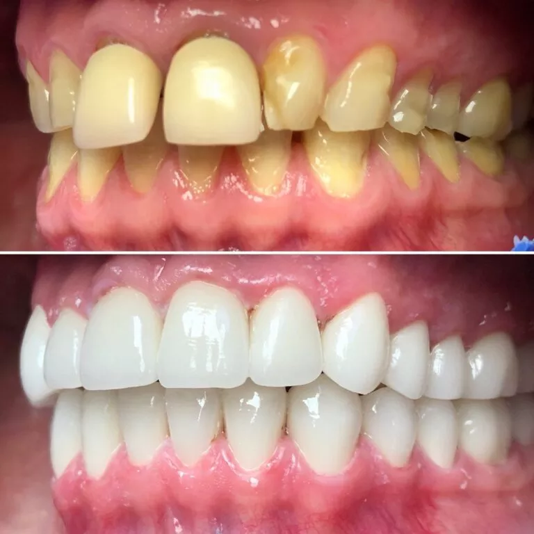 Dental health in Hungary